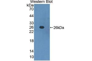 Western blot analysis of the recombinant protein. (SOCS3 Antikörper  (AA 1-225))