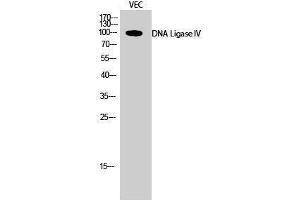 Western Blotting (WB) image for anti-Ligase IV, DNA, ATP-Dependent (LIG4) (Internal Region) antibody (ABIN3184324)