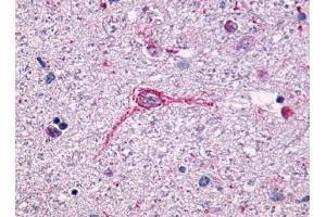 Immunohistochemical staining of Brain (Neurons and glia) using anti- NTSR1 antibody ABIN122340 (NTSR1 Antikörper  (N-Term))