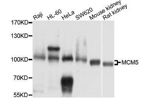 MCM5 Antikörper  (AA 1-230)