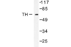 Image no. 1 for anti-Tyrosine Hydroxylase (TH) antibody (ABIN271919) (Tyrosine Hydroxylase Antikörper)