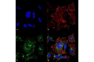 Immunocytochemistry/Immunofluorescence analysis using Mouse Anti-NPAS4 Monoclonal Antibody, Clone S408-79 (ABIN2485822). (NPAS4 Antikörper  (AA 597-802) (PE))