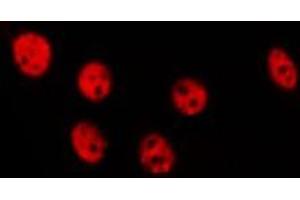ABIN6275632 staining Hela by IF/ICC. (TOR1AIP1 Antikörper  (Internal Region))