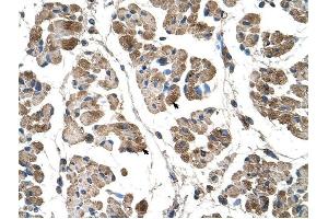 Alpha Actinin 2 antibody was used for immunohistochemistry at a concentration of 4-8 ug/ml to stain Skeletal muscle cells (arrows) in Human Muscle. (ACTN2 Antikörper  (C-Term))