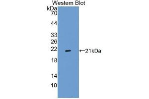 Western Blotting (WB) image for anti-Integrin Alpha2b (CD41) (AA 891-1039) antibody (ABIN1868769) (Integrin Alpha2b Antikörper  (AA 891-1039))