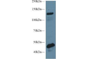 Detection of MGEA5 in Rat Cerebrum lysate using Polyclonal Antibody to Meningioma Expressed Antigen 5 (MGEA5) (MGEA5 Antikörper  (AA 6-240))