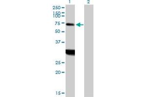 Western Blot analysis of ZNF238 expression in transfected 293T cell line by ZNF238 MaxPab polyclonal antibody. (ZNF238 Antikörper  (AA 1-522))