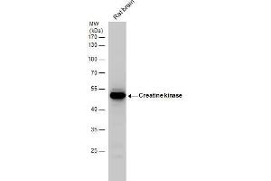 WB Image Creatine kinase (brain) antibody detects Creatine kinase protein by western blot analysis. (CKB Antikörper)
