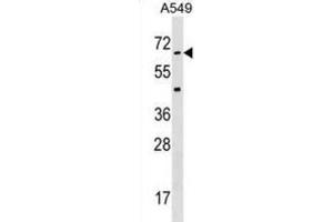 Western Blotting (WB) image for anti-Serine/threonine Kinase 35 (STK35) antibody (ABIN3003075) (STK35 Antikörper)