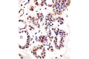 Immunohistochemical analysis of paraffin-embedded H. (T-Box 1 Antikörper  (C-Term))