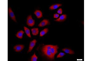 MCF-7 cells were stained with NFKB Polyclonal Antibody, Unconjugated at 1:500 in PBS and incubated for two hours at 37°C followed by Goat Anti-Rabbit IgG (H+L) Cy3 conjugated secondary antibody.