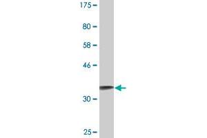 Western Blot detection against Immunogen (36. (S100A2 Antikörper  (AA 1-97))