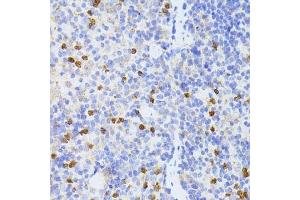 Immunohistochemistry of paraffin-embedded mouse spleen using SMAD2 antibody. (SMAD2 Antikörper  (AA 1-100))