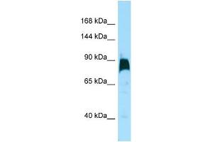 Western Blotting (WB) image for anti-Kinesin Family Member 7 (KIF7) (C-Term) antibody (ABIN2490336) (KIF7 Antikörper  (C-Term))