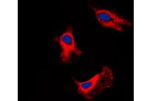 Immunofluorescent analysis of Adenosine A2b Receptor staining in SHSY5Y cells. (Adenosine A2b Receptor Antikörper  (C-Term))