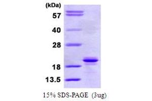 SDS-PAGE (SDS) image for Signaling threshold Regulating Transmembrane Adaptor 1 (SIT1) (AA 1-196) protein (His tag) (ABIN6386801) (SIT1 Protein (AA 1-196) (His tag))