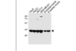 All lanes : Anti-LDHA Antibody (C-term) at 1:2000 dilution Lane 1: Daudi whole cell lysate Lane 2: HepG2 whole cell lysate Lane 3: MOLT-4 whole cell lysate Lane 4: MDA-MB-231 whole cell lysate Lane 5: Mouse skeletal muscle lysate Lane 6: Rat skeletal muscle lysate Lysates/proteins at 20 μg per lane.