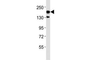 Western blot testing of ERBB4 antibody at 1:500 dilution + rat brain lysate; Predicted molecular weight: 147-180 kDa (precursor), 120, 80 kDa (cleaved forms).