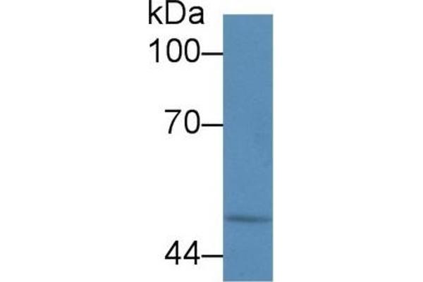 Calreticulin Antikörper  (AA 196-310)