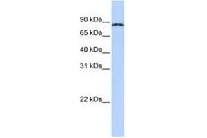 Image no. 1 for anti-Cytoplasmic Polyadenylation Element Binding Protein 4 (CPEB4) (AA 72-121) antibody (ABIN6740707) (CPEB4 Antikörper  (AA 72-121))