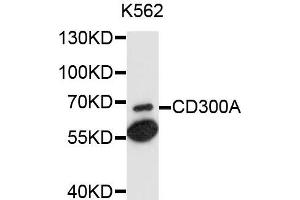 Western blot analysis of extracts of K562 cells, using CD300A antibody. (CD300a Antikörper)