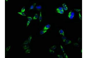 Immunofluorescence staining of Hela cells with ABIN7171365 at 1:166, counter-stained with DAPI. (CD2 Antikörper  (AA 25-209))