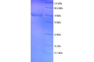 Ribosomal Protein S18 (RPS18) (AA 2-152), (full length) protein (GST tag) (RPS18 Protein (AA 2-152, full length) (GST tag))