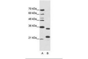 Image no. 1 for anti-AlkB, Alkylation Repair Homolog 8 (ALKBH8) (AA 141-190) antibody (ABIN1099945) (ALKBH8 Antikörper  (AA 141-190))