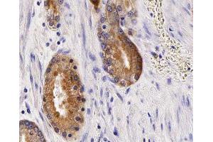 ABIN6266929 at 1/100 staining human Prostate tissue sections by IHC-P. (Anoctamin 7 Antikörper  (Internal Region))