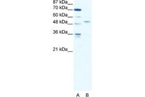 Western Blotting (WB) image for anti-Interferon Regulatory Factor 5 (IRF5) antibody (ABIN2461651) (IRF5 Antikörper)