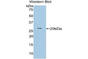 Detection of Recombinant PDXK, Human using Polyclonal Antibody to Pyridoxal Kinase (PDXK) (PDXK Antikörper  (AA 29-253))