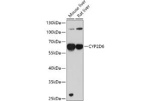 Western blot analysis of extracts of various cell lines, using CYP2D6 antibody (ABIN1512811, ABIN3021880, ABIN3021882 and ABIN6216807) at 1:1000 dilution. (CYP2D6 Antikörper  (AA 20-230))