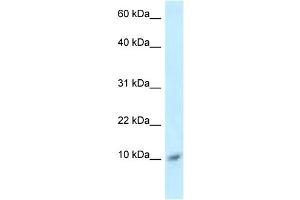 WB Suggested Anti-S100A8 Antibody Titration: 1. (S100A8 Antikörper  (Middle Region))
