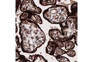 Immunohistochemical staining (Formalin-fixed paraffin-embedded sections) of human placenta shows strong cytoplasmic immunoreactivity in trophoblasts. (PPIB Antikörper)