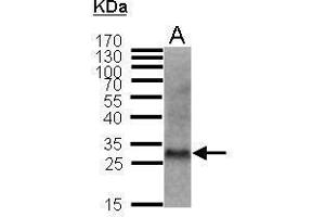 WB Image Sample (50 ug of whole cell lysate) A: MFB (mouse fibroblast) 12% SDS PAGE antibody diluted at 1:1000 (CDKN1B Antikörper)