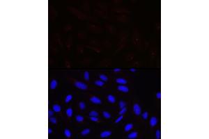 Immunofluorescence analysis of U-2 OS cells using PCNT Rabbit pAb (ABIN7269216) at dilution of 1:100 (40x lens). (PCNT Antikörper)