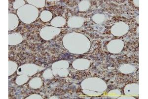 Image no. 1 for anti-Major Histocompatibility Complex, Class II, DM alpha (HLA-DMA) (AA 1-262) antibody (ABIN598734) (HLA-DMA Antikörper  (AA 1-262))