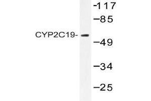 Western blot analysis of CYP2C19 antibody in extracts from 293 cells. (CYP2C19 Antikörper)