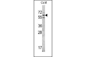 Western blot analysis of RIOK2 Center in CEM cell line lysates (35ug/lane) (RIOK2 Antikörper  (AA 270-299))
