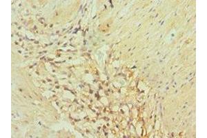 Immunohistochemistry (IHC) image for anti-Aldo-Keto Reductase Family 1, Member C3 (3-alpha Hydroxysteroid Dehydrogenase, Type II) (AKR1C3) (AA 1-323) antibody (ABIN7143694)