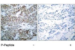 Image no. 1 for anti-BCL2-Associated Agonist of Cell Death (BAD) (pSer112), (pSer75) antibody (ABIN196734) (BAD Antikörper  (pSer75, pSer112))