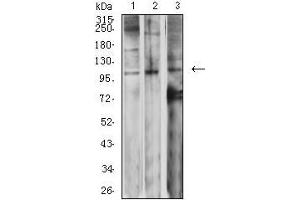 Western blot analysis using GRM2 mouse mAb against SK-N-SH (1), Jurkat (2), and SW620 (3) cell lysate. (GRM2 Antikörper  (AA 414-558))