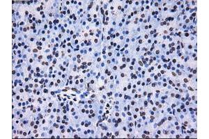 Image no. 9 for anti-Replication Protein A2, 32kDa (RPA2) antibody (ABIN1500735)