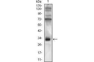 Western blot analysis using CD74 mouse mAb against Raji cell lysate. (CD74 Antikörper  (AA 1-106))
