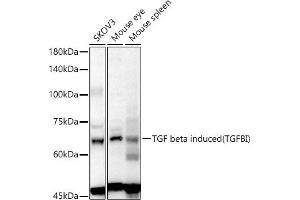 Western blot analysis of extracts of various cell lines, using TGF beta induced (TGFBI) antibody (ABIN6128864, ABIN6149078, ABIN6149080 and ABIN6215116) at 1:1000 dilution. (TGFBI Antikörper  (AA 481-683))