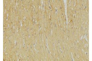 ABIN6269251 at 1/100 staining Mouse muscle tissue by IHC-P.