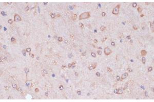 Immunohistochemistry of paraffin-embedded Mouse brain using CARTPT Polyclonal Antibody at dilution of 1:100 (40x lens). (CARTPT Antikörper)