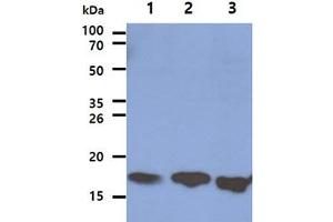 The Cell lysates (40ug) were resolved by SDS-PAGE, transferred to PVDF membrane and probed with anti-human LSM5 antibody (1:1000). (LSM5 Antikörper)