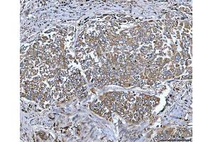 IHC analysis of Tripeptidyl peptidase II/TPPII/TPP2 using anti-Tripeptidyl peptidase II/TPPII/TPP2 antibody (ABIN7601293). (Tpp2 Antikörper  (AA 32-1001))