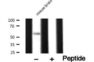 Western Blotting (WB) image for anti-Peripherin (PRPH) (C-Term) antibody (ABIN6264142)